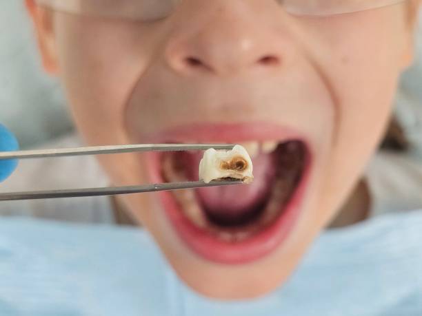 Best Cracked Tooth Emergency Dentist  in Valle Vista, AZ